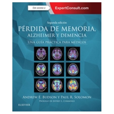 Pérdida de memoria, Alzheimer y Demencia